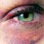 A0310-Violence-and-health-insurance_leader